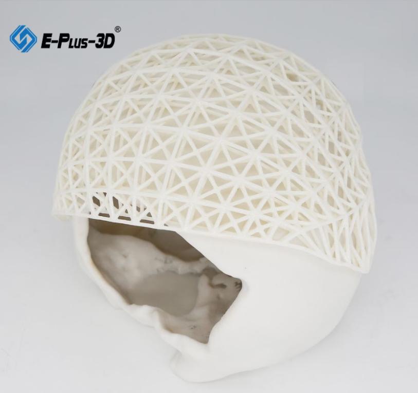 Why Choose Sls 3d Printing