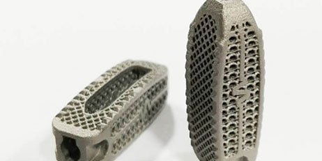 Advantages of Metal 3D Printed Orthopedic Implants
