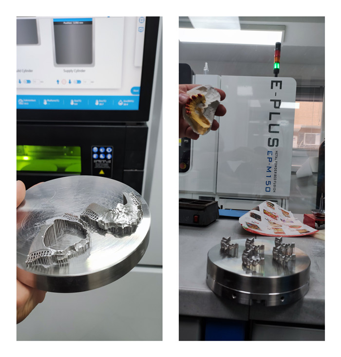 Another Dental Metal 3D Printer From Eplus 3D Was Installed In Europe -  Eplus3D