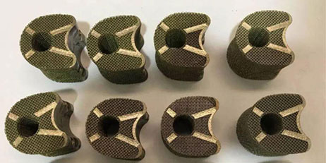 3D Printing For Orthopedic Implant