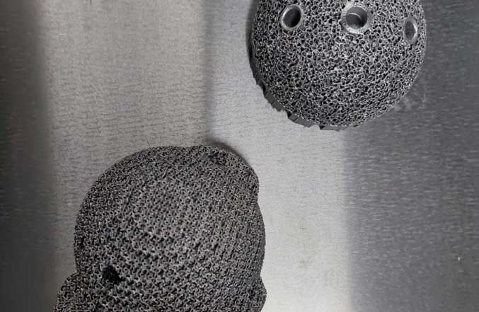 The Future of 3D Printing in Personalized Implants