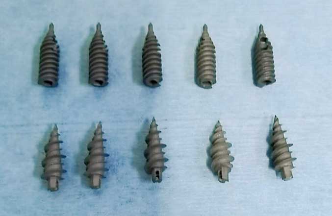 3D Printed Medical Bone Screws Improves Spinal Surgery Recovery