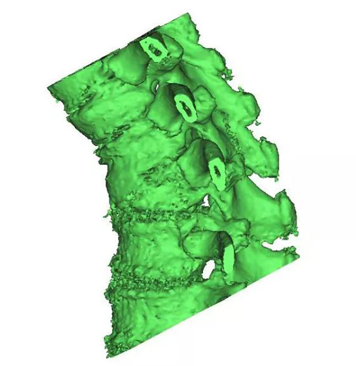 3d-printed-surgical-guide-for-medical-application-1.jpg