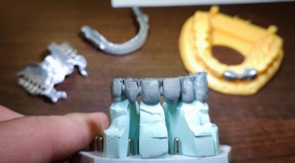 How to choose the Right Dental 3D Printer