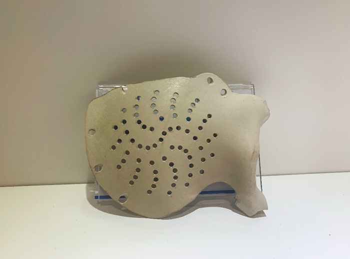 Manufacturing and Materials of 3D Printed Cranial Plates
