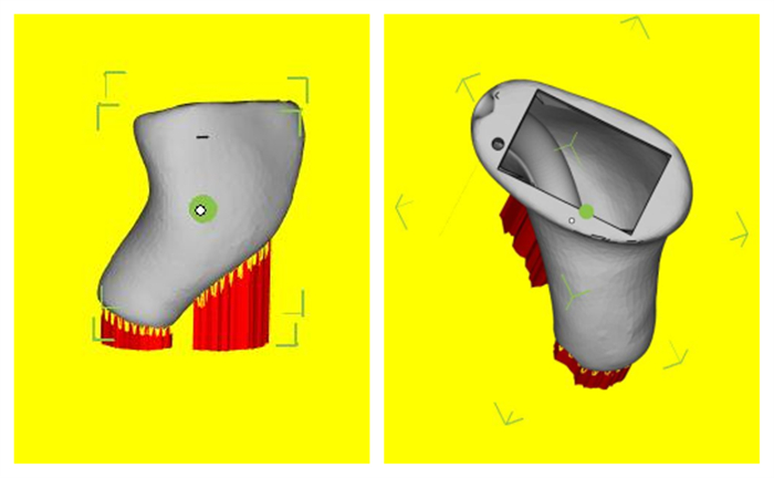 Titanium 3D Printed Cochlear Hearing Aids