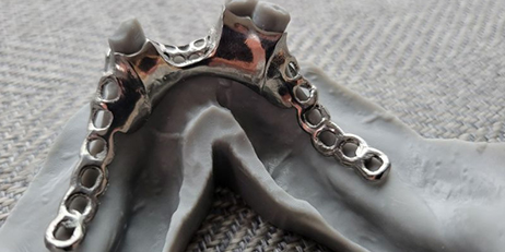 Advantages of Metal 3D Printed Porous Titanium Dental Implants