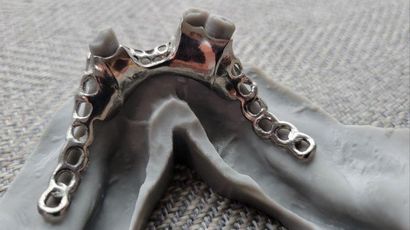 Advantages of Metal 3D Printed Porous Titanium Dental Implants